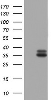 Western blot analysis of anti-Phospho-p53-T18 Pab (cat# TA324776) in, from left to right, A2058, Ramos, mouse lung, mouse testis, and HL60 cell line lysates. Phospho-p53-T18 (arrow) was detected using the purified Pab.