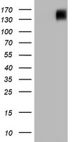 Western blot analysis of extracts from NIH-3T3 cells, untreated or treated with PDGF, using Phospho-Akt (Ser473) (left) or Akt antibody (right).