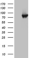 Western blot analysis of ERK1/2 (arrow) using rabbit polyclonal P-MAPK (T202/Y204) (Cat.#TA324783). HAOSMC cell lysates either transiently induced (Lane 2) or noninduced with the PDGF (Lane 1) (2ug/lane).