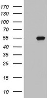 Western blot analysis of extracts from Jurkat cells, untreated or treated with paclitaxel, using phospho-Bcl2 (Ser70) (left) or Bcl2 antibody (right).