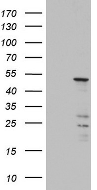 Western blot analysis of HIF1A Antibody (N-term) (Cat. #TA324790) in CHO cell line lysates (35ug/lane). HIF1A (arrow) was detected using the purified Pab.