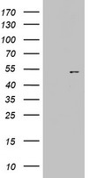 HSP90B1 Antibody (N-term) (Cat. #TA324795) western blot analysis in HepG2, CHO, K562, Hela cell line and mouse liver tissue lysates (35ug/lane).This demonstrates the HSP90B1 antibody detected the HSP90B1 protein (arrow).