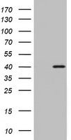Western blot analysis of TSH2 Antibody (N-term) (Cat. #TA324804) in CEM cell line lysates (35ug/lane).TSH2 (arrow) was detected using the purified Pab.