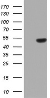 HEK293T cells were transfected with the pCMV6-ENTRY control (Left lane) or pCMV6-ENTRY ZNF385B (RC210354, Right lane) cDNA for 48 hrs and lysed. Equivalent amounts of cell lysates (5 ug per lane) were separated by SDS-PAGE and immunoblotted with anti-ZNF385B. Positive lysates LY407475 (100ug) and LC407475 (20ug) can be purchased separately from OriGene.