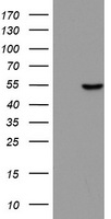 HEK293T cells were transfected with the pCMV6-ENTRY control (Left lane) or pCMV6-ENTRY ZNF385B (RC210354, Right lane) cDNA for 48 hrs and lysed. Equivalent amounts of cell lysates (5 ug per lane) were separated by SDS-PAGE and immunoblotted with anti-ZNF385B. Positive lysates LY407475 (100ug) and LC407475 (20ug) can be purchased separately from OriGene.