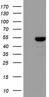TBP Antibody (Center) (Cat. #TA324859) western blot analysis in K562, U251 cell line lysates (35ug/lane).This demonstrates the TBP antibody detected the TBP protein (arrow).