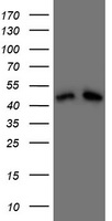 OTC Antibody (Center) (Cat.# TA324880) western blot analysis in SW620 cell line and mouse liverÃ¯rat liver lysates (35ug/lane).This demonstrates the OTC antibody detected the OTC protein (arrow).