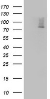 Western blot analysis of ARGBP2 Antibody (N-term) (Cat. #TA324888) in MDA-MB231 cell line lysates (35ug/lane). ARGBP2 (arrow) was detected using the purified Pab.
