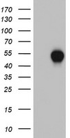 POLE3 Antibody (N-term) (Cat. #TA324920) western blot analysis in K562 cell line lysates (35ug/lane).This demonstrates the POLE3 antibody detected the POLE3 protein (arrow).