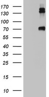 Western blot analysis of NQO1 antibody (Center) (Cat.#TA324929) in NCI-H460 cell line lysates (35ug/lane). NQO1 (arrow) was detected using the purified Pab.
