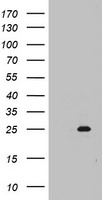 Western blot analysis of SMAD2 Antibody (Cat.# TA324932) in NIH-3T3 cell line lysates (35ug/lane). SMAD2 (arrow) was detected using the purified Pab.