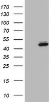 Western blot analysis of EN2 antibody (C-term) (Cat.# TA324936) in 293 cell line lysates and mouse stomach and lung tissue lysates (35ug/lane). EN2 (arrow) was detected using the purified Pab.