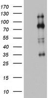 Western blot analysis of FYN Antibody (N-term) (Cat. #TA324974) in Hela cell line lysates (35ug/lane). FYN (arrow) was detected using the purified Pab.