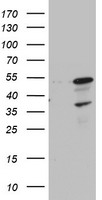 NRAS Antibody (C-term) (Cat. #TA324983) western blot analysis in MCF-7 cell line lysates (35ug/lane).This demonstrates the NRAS antibody detected the NRAS protein (arrow).