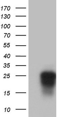 Western blot analysis of SMAD4 (arrow) using rabbit polyclonal SMAD4 Antibody (C-term) (Cat. #TA324984). 293 cell lysates (2ug/lane) either nontransfected (Lane 1) or transiently transfected with the SMAD4 gene (Lane 2).