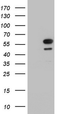 HSP90AB1 Antibody (Center) (Cat.# TA324997) western blot analysis in A431, Hela, L6 cell line lysates (35ug/lane).This demonstrates the HSP90AB1 antibody detected the HSP90AB1 protein (arrow).
