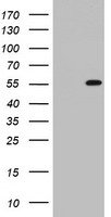 Western blot analysis of GAPDH Antibody (C-term R248) (Cat.#TA325001) in A2058, A375, CEM cell line lysates (35ug/lane). GAPDH (arrow) was detected using the purified Pab.