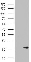 Western blot analysis of PPP1CB (arrow) using rabbit polyclonal PPP1CB Antibody (K301) (Cat. #TA325036). 293 cell lysates (2ug/lane) either nontransfected (Lane 1) or transiently transfected (Lane 2) with the PPP1CB gene.