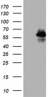 TPT1 Antibody (Center) (Cat. #TA325038) western blot analysis in LNCaP cell line lysates (35ug/lane).This demonstrates the TPT1 antibody detected the TPT1 protein (arrow).