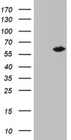 Western blot analysis of IGFBP2 Antibody (C-term) (Cat. #TA325050) in Jurkat cell line lysates (35ug/lane).IGFBP2 (arrow) was detected using the purified Pab. (2ug/ml)