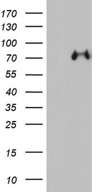 Western blot analysis of SCP2 Antibody (Center) (Cat. #TA325058) in A2058 cell line lysates (35ug/lane). SCP2 (arrow) was detected using the purified Pab.