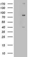 Western blot analysis of VPS26A Antibody (Center) (Cat. #TA325067) in HepG2 cell line lysates (35ug/lane). VPS26A (arrow) was detected using the purified Pab.