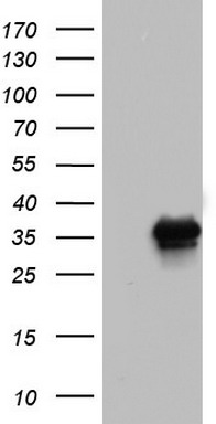 Western blot analysis of lysates from Hela, HepG2, HL-60, Ramos, mouse brain cell line (from left to right), using GOT2 Antibody (N-term) (Cat. #TA325088). TA325088 was diluted at 1:1000 at each lane. A goat anti-rabbit IgG H&L (HRP) at 1:5000 dilution was used as the secondary antibody. Lysates at 35ug per lane.