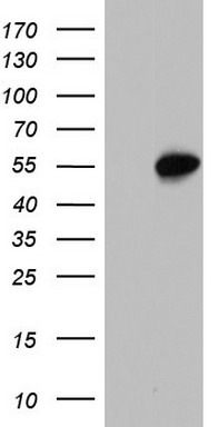 Western blot analysis of JUP Antibody (C-term) (Cat. #TA325089) in MCF-7 cell line lysates (35ug/lane). JUP (arrow) was detected using the purified Pab.