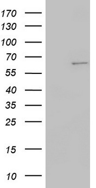SMAD3 Antibody (S208) (Cat. #TA325124) western blot analysis in HepG2 and mouse C2C12 cell line lysates (35ug/lane).This demonstrates the SMAD3 antibody detected the SMAD3 protein (arrow).