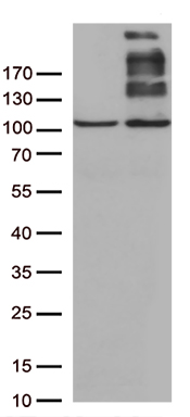 /assets/images/antibody/100/ta803259-1-w.jpg