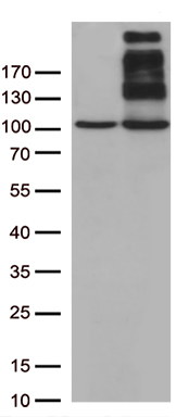 /assets/images/antibody/100/ta803275-1-w.jpg