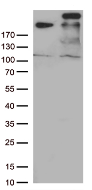 /assets/images/antibody/100/ta803310-1-w.jpg