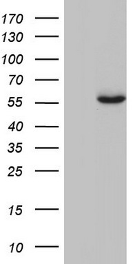 Western blot analysis of ATF2 phosphorylation expression in MDA-MB-435 whole cell lysates, The lane on the left is treated with the antigen-specific peptide.