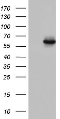 Western blot analysis of ATF2 phosphorylation expression in TNF-a treated HeLa whole cell lysates, The lane on the left is treated with the antigen-specific peptide.