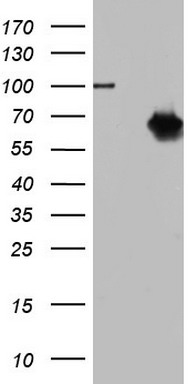 Western blot analysis of ATF2 phosphorylation expression in LOVO whole cell lysates, The lane on the left is treated with the antigen-specific peptide.