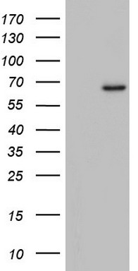 Western blot analysis of ATF2 phosphorylation expression in HeLa whole cell lysates, The lane on the left is treated with the antigen-specific peptide.