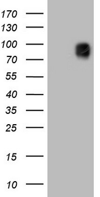 HEK293T cells were transfected with the pCMV6-ENTRY control (Left lane) or pCMV6-ENTRY NR2C1 (RC208060, Right lane) cDNA for 48 hrs and lysed. Equivalent amounts of cell lysates (5 ug per lane) were separated by SDS-PAGE and immunoblotted with anti-NR2C1. Positive lysates LY422297 (100 ug) and LC422297 (20 ug) can be purchased separately from OriGene.