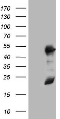 HEK293T cells were transfected with the pCMV6-ENTRY control (Left lane) or pCMV6-ENTRY NR2C1 (RC208060, Right lane) cDNA for 48 hrs and lysed. Equivalent amounts of cell lysates (5 ug per lane) were separated by SDS-PAGE and immunoblotted with anti-NR2C1. Positive lysates LY422297 (100 ug) and LC422297 (20 ug) can be purchased separately from OriGene.
