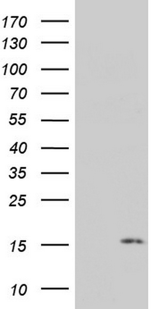 HEK293T cells were transfected with the pCMV6-ENTRY control (Left lane) or pCMV6-ENTRY PYDC1 (RC211240, Right lane) cDNA for 48 hrs and lysed. Equivalent amounts of cell lysates (5 ug per lane) were separated by SDS-PAGE and immunoblotted with anti-PYDC1. Positive lysates LY407263 (100ug) and LC407263 (20ug) can be purchased separately from OriGene.