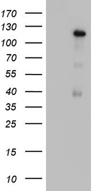 HEK293T cells were transfected with the pCMV6-ENTRY control (Left lane) or pCMV6-ENTRY C11orf67 (RC201033, Right lane) cDNA for 48 hrs and lysed. Equivalent amounts of cell lysates (5 ug per lane) were separated by SDS-PAGE and immunoblotted with anti-C11orf67. Positive lysates LY411144 (100 ug) and LC411144 (20 ug) can be purchased separately from OriGene.