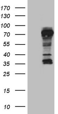 HEK293T cells were transfected with the pCMV6-ENTRY control (Left lane) or pCMV6-ENTRY NRBF2 (RC204061, Right lane) cDNA for 48 hrs and lysed. Equivalent amounts of cell lysates (5 ug per lane) were separated by SDS-PAGE and immunoblotted with anti-NRBF2. Positive lysates LY410731 (100 ug) and LC410731 (20 ug) can be purchased separately from OriGene.
