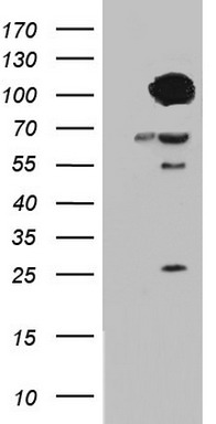 HEK293T cells were transfected with the pCMV6-ENTRY control (Left lane) or pCMV6-ENTRY BFSP1 (RC213412, Right lane) cDNA for 48 hrs and lysed. Equivalent amounts of cell lysates (5 ug per lane) were separated by SDS-PAGE and immunoblotted with anti-BFSP1. Positive lysates LY420073 (100ug) and LC420073 (20ug) can be purchased separately from OriGene.