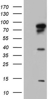 HEK293T cells were transfected with the pCMV6-ENTRY control (Left lane) or pCMV6-ENTRY BFSP1 (RC213412, Right lane) cDNA for 48 hrs and lysed. Equivalent amounts of cell lysates (5 ug per lane) were separated by SDS-PAGE and immunoblotted with anti-BFSP1. Positive lysates LY420073 (100ug) and LC420073 (20ug) can be purchased separately from OriGene.