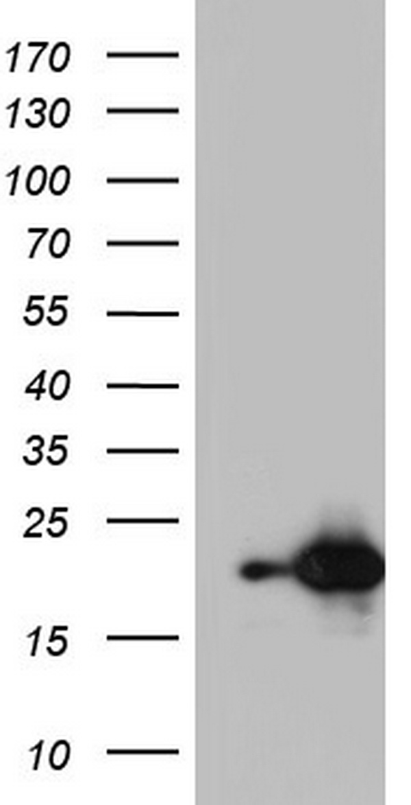 HEK293T cells were transfected with the pCMV6-ENTRY control (Left lane) or pCMV6-ENTRY TET3 (RC214497, Right lane) cDNA for 48 hrs and lysed. Equivalent amounts of cell lysates (5 ug per lane) were separated by SDS-PAGE and immunoblotted with anti-TET3.