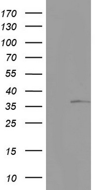 HEK293T cells were transfected with the pCMV6-ENTRY control (Left lane) or pCMV6-ENTRY TET3 (RC214497, Right lane) cDNA for 48 hrs and lysed. Equivalent amounts of cell lysates (5 ug per lane) were separated by SDS-PAGE and immunoblotted with anti-TET3.