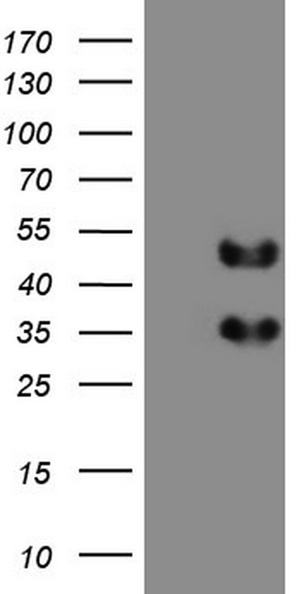 Human recombinant protein fragment corresponding to amino acids 1787-2144 of human SETD2 (NP_054878) produced in E.coli (1:500).