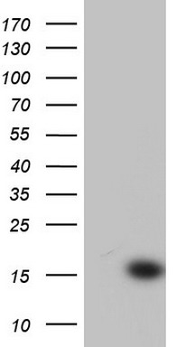 HEK293T cells were transfected with the pCMV6-ENTRY control (Left lane) or pCMV6-ENTRY CETN1 (RC206285, Right lane) cDNA for 48 hrs and lysed. Equivalent amounts of cell lysates (5 ug per lane) were separated by SDS-PAGE and immunoblotted with anti-CETN1. Positive lysates LY401316 (100ug) and LC401316 (20ug) can be purchased separately from OriGene.