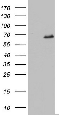 HEK293T cells were transfected with the pCMV6-ENTRY control (Left lane) or pCMV6-ENTRY IKZF3 (RC207547, Right lane) cDNA for 48 hrs and lysed. Equivalent amounts of cell lysates (5 ug per lane) were separated by SDS-PAGE and immunoblotted with anti-IKZF3. Positive lysates LY402225 (100ug) and LC402225 (20ug) can be purchased separately from OriGene.