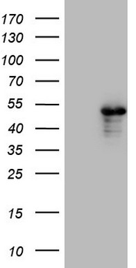 Human recombinant protein fragment corresponding to amino acids 1787-2144 of human SETD2 (NP_054878) produced in E.coli (1:200).