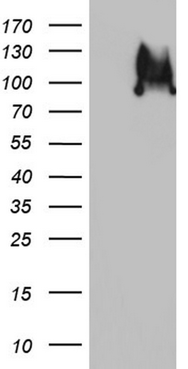 HEK293T cells were transfected with the pCMV6-ENTRY control (Left lane) or pCMV6-ENTRY FOSB (RC207004, Right lane) cDNA for 48 hrs and lysed. Equivalent amounts of cell lysates (5 ug per lane) were separated by SDS-PAGE and immunoblotted with anti-FOSB. Positive lysates LY402011 (100 ug) and LC402011 (20 ug) can be purchased separately from OriGene.